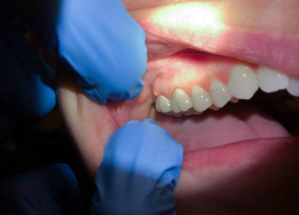 Best Pediatric Emergency Dentist in Bowdon, GA