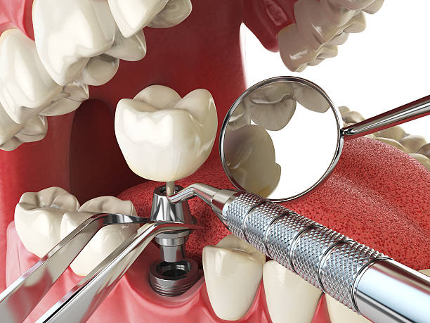 Best Broken or Cracked Tooth Emergency Dentist in Bowdon, GA